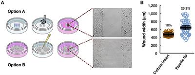 adhesion migration cell vitro invasion imaging assays